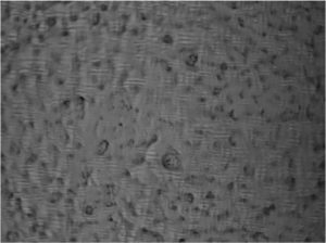 FIGURE 2—Confocal microscopy of the hard matter PUD (left, 100x mag/size 178x134um) vs a PUD with 1.5% pyrogenic silica (right)